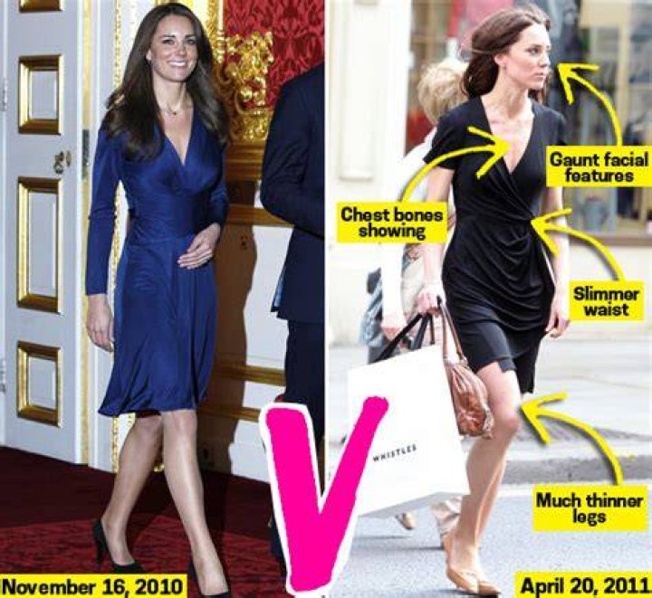 Poor Kate Middleton, You're Skin & Bones! Are You Suffering From An Eating Disorder Like Princess Diana? – Hollywood Life