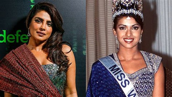 Priyanka Chopra Says Botched Plastic Surgery Caused A ‘Depression’ – Hollywood Life