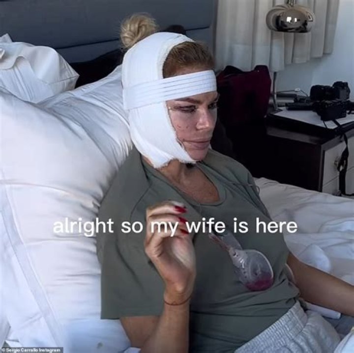 Real Housewives of Dubai’s Caroline Stanbury Says She Used Ozempic to Lose Weight
