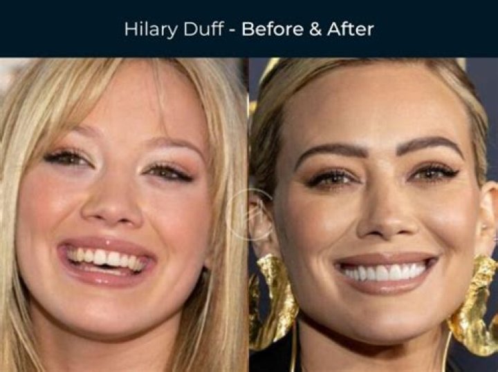 Reveals Her Amazing Natural Look – Hollywood Life