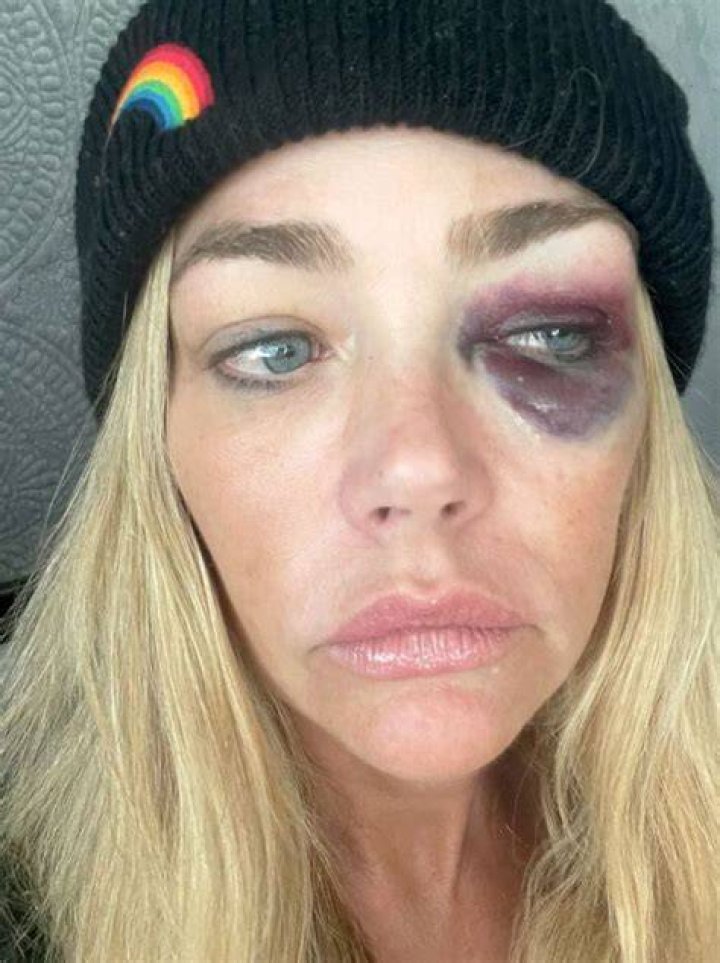 ‘RHOBH’s Erika & Teddi Left Stunned After Aaron Threatens To ‘Crush’ Denise Richards’ Hand — Watch