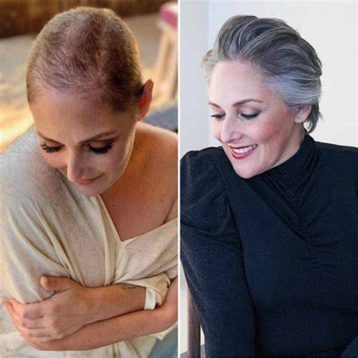Ricky Lake Shows Short Hair Transformation Amid Alopecia Battle – Hollywood Life