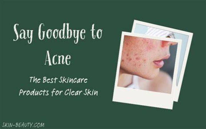 Say Goodbye To Acne With These Best-Selling Preventative Products All Around $15