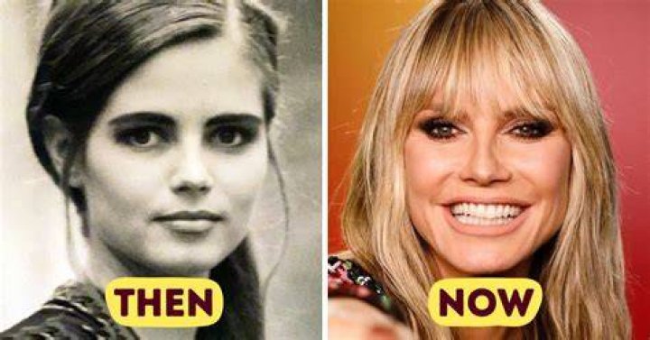 See Their Transformations Over The Years – Hollywood Life
