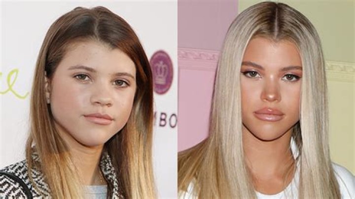 Sofia Richie’s Lips Look Bigger As She Rocks White Shorts At NYFW – Hollywood Life