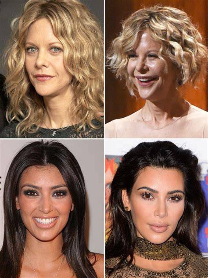 Stars Whose Faces Have Changed – Hollywood Life