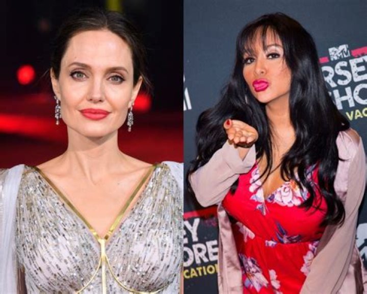 Stars With Plumped-Up Lips — PICS