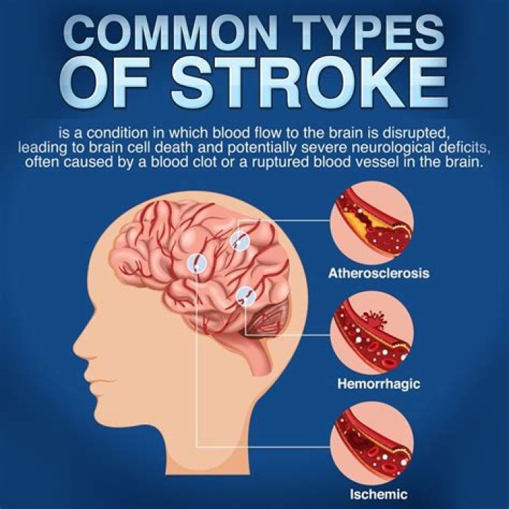 Stroke Caused By Nasty Fall At Photo Shoot 1 Week Earlier – Hollywood Life