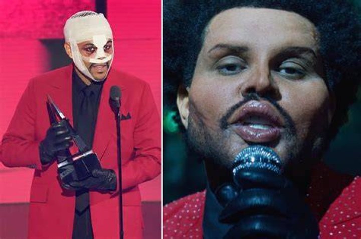 The Weeknd Shows Off Prosthetic Fillers In ‘Save Your Tears’ Video – Hollywood Life