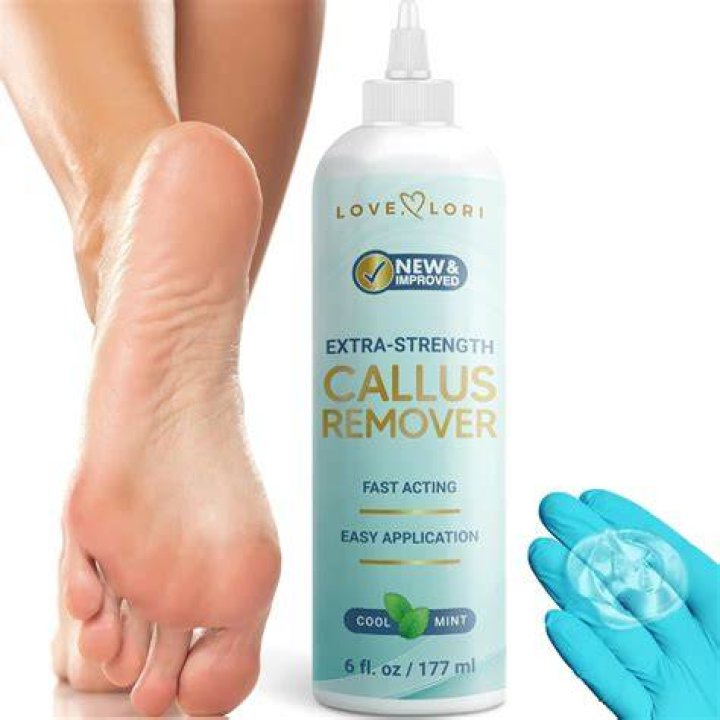 This Wildly Popular Callus Remover Is So Effective You’ll Be A ‘Smooth Criminal’ In No Time