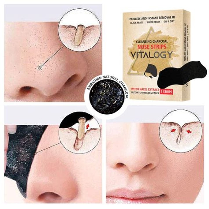 Top Nose Strip Blackhead Removers in 2023 – Reviews by Hollywood Life – Hollywood Life