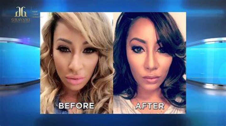 [VIDEO] ‘LHH’ Hazel’s Vagina Lift — Watch The Live Stream Of Her Procedure – Hollywood Life